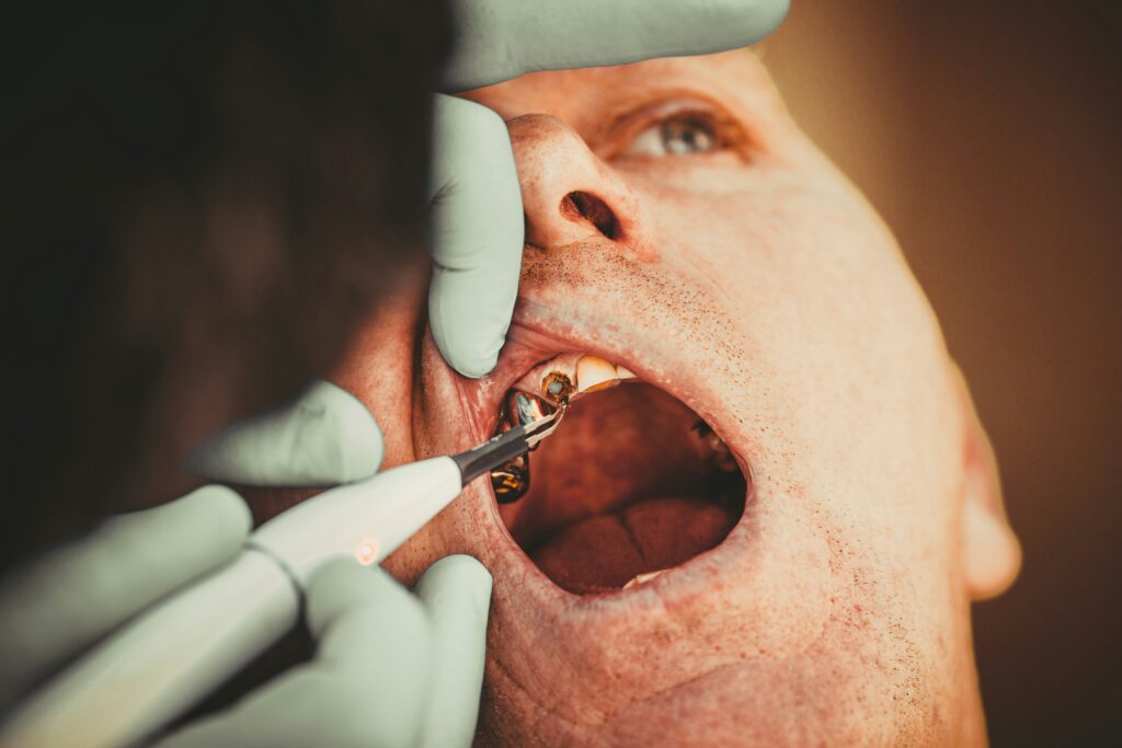 Legătura dintre sănătatea orală și boli precum diabetul