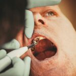 Legătura dintre sănătatea orală și boli precum diabetul